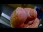 How to Grow a New Fingertip | World's Strangest