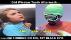 MonoNeon: Girl Wisdom Teeth Aftermath - I'm Choking On Big, Fat Black Di*k