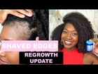 Shaved Off Edges To Grow Them Back Thicker & Vicks Vapor Rub: Week 6 Update | Traction Alopecia | #6