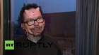 Germany: World's most pierced man shows why Dubai denied him entry